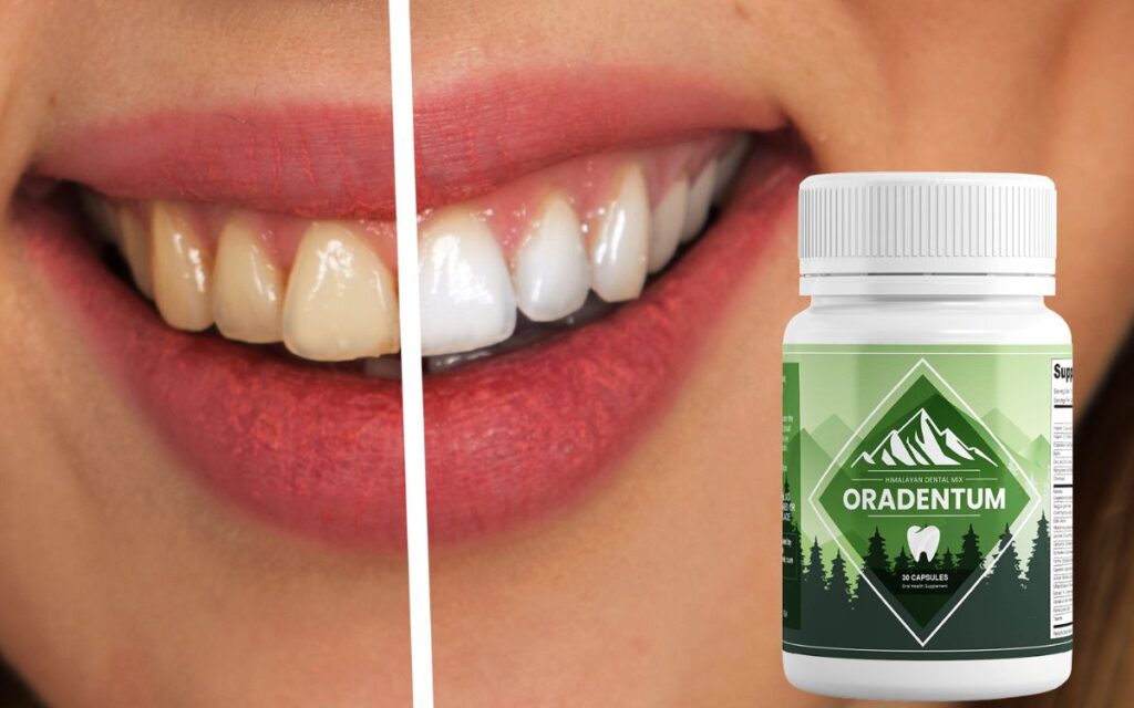 Oradentum Review: Can a Pill Fix Your Mouth?