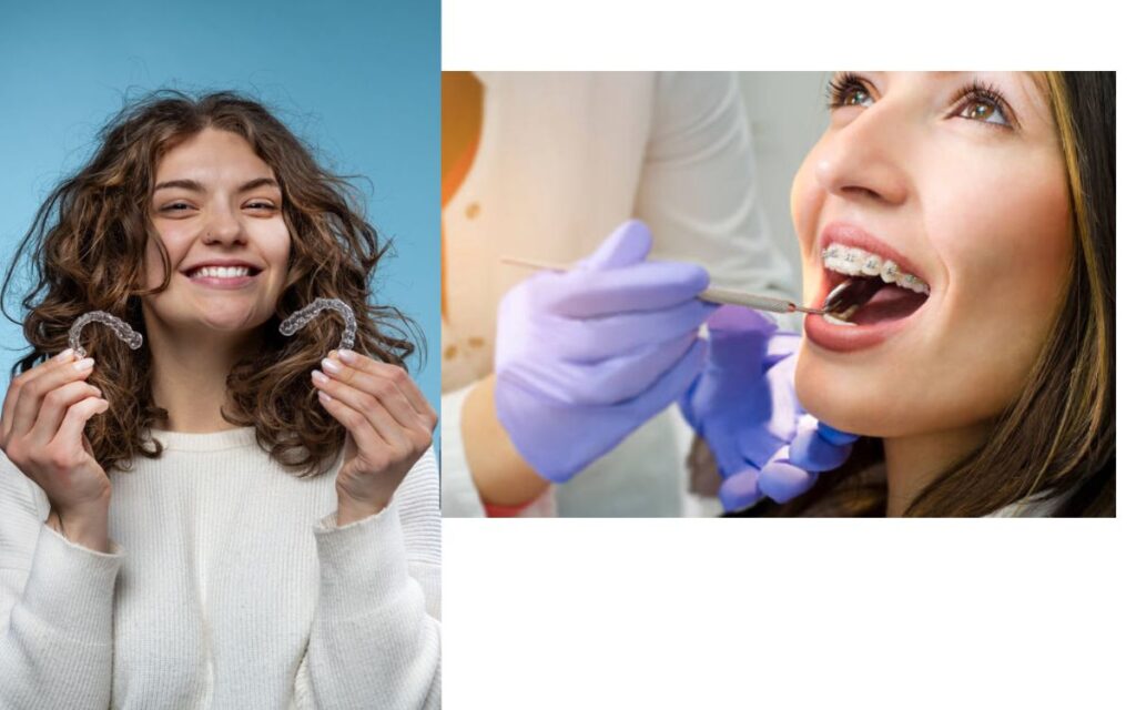 Invisalign vs Braces for Teeth