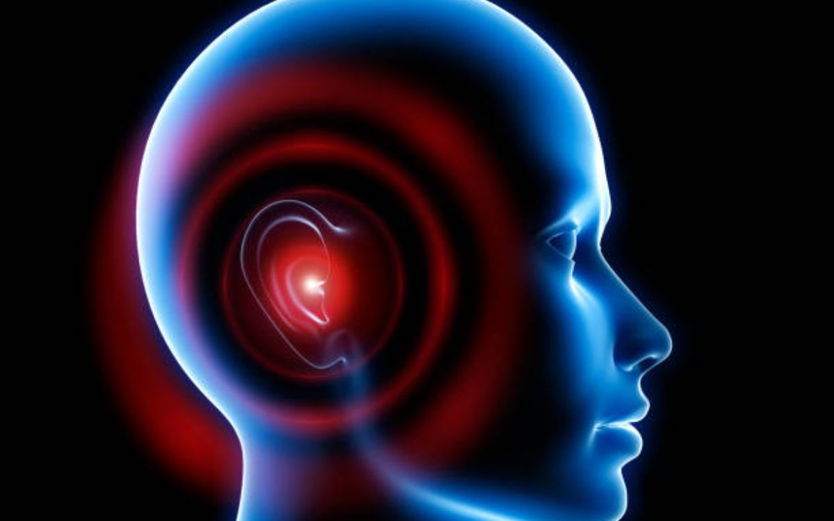 Sudden Onset Tinnitus Without Hearing Loss Causes